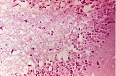 First Commercially Available Venezuela Equine Encephalitis Virus (VEEV) Protein Announced